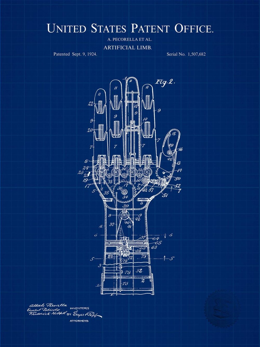 Work / School / Office | Artificial Limb Design | 1929 Patent Carnival / Steampunk / Occult Antique